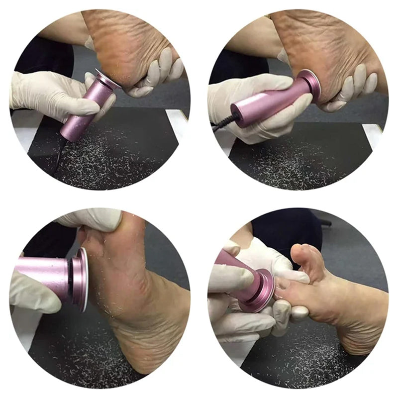 Ponceuse Pieds Électrique Anti-Callosités Professionnel Domicile – Image 3